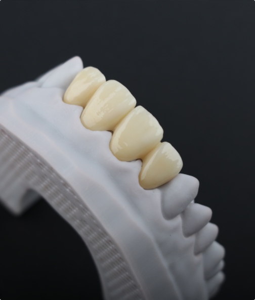 zirconia-3