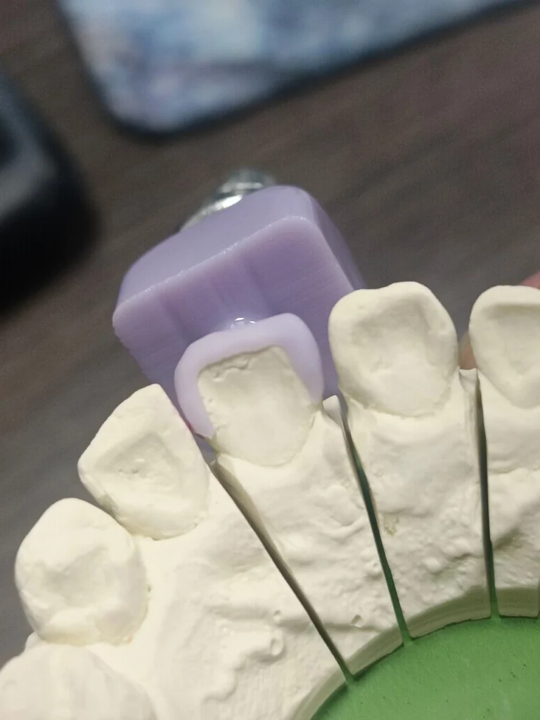 JINY Dental glass ceramic blocks for crowns front